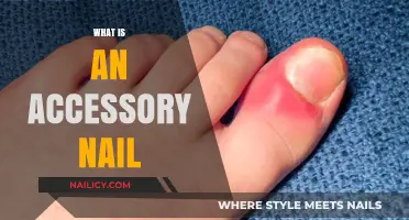 Understanding Accessory Nails: Causes, Symptoms, and Treatment Options Explained