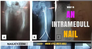Understanding Intramedullary Nails: Purpose, Procedure, and Recovery Explained