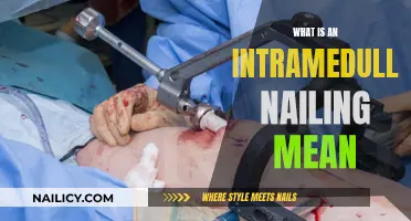 Intramedullary Nailing: What It Is and How It Works