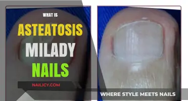 Understanding Asteatosis in Milady Nails: Causes, Symptoms, and Treatment Options