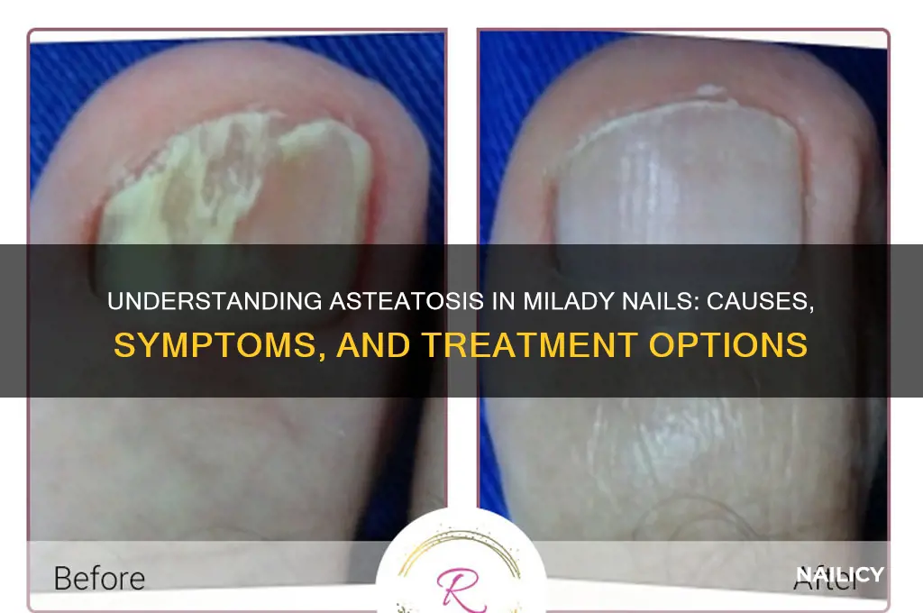 what is asteatosis milady nails