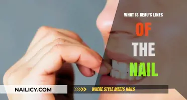 Understanding Beau's Lines: Causes, Symptoms, and Nail Health Insights