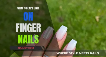 Unraveling the Mystery: Beau's Lines on Finger Nails