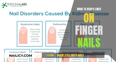 Beau's Lines: Understanding Nail Abnormalities and Health
