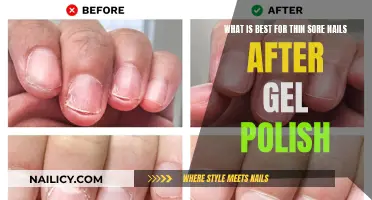 Heal Thin, Sore Nails: Post-Gel Polish Care