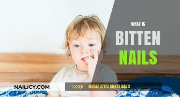 Understanding the Habit: What Bitten Nails Reveal About You