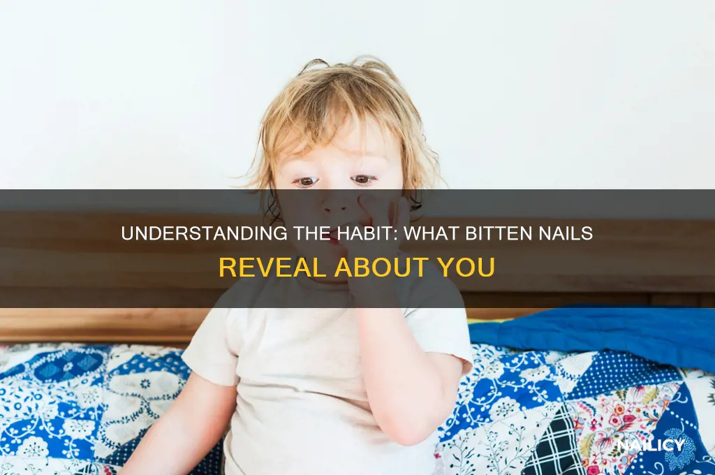 what is bitten nails