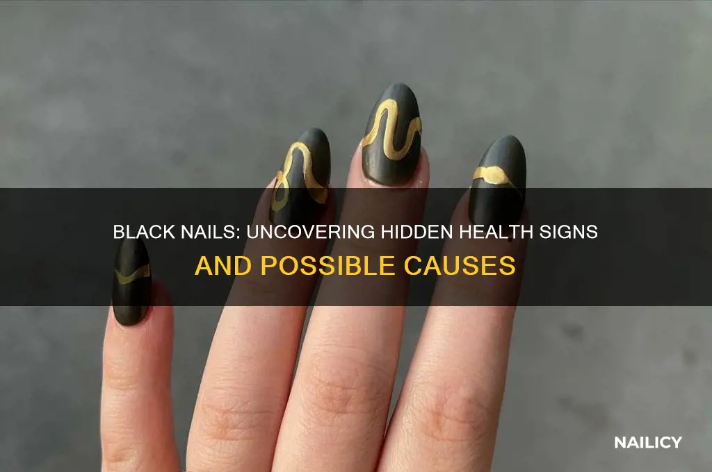 what is black nails a sign of