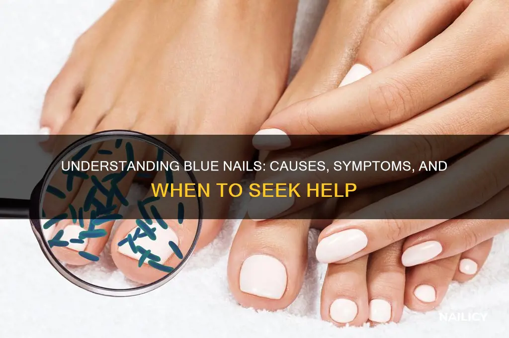 what is blue nail