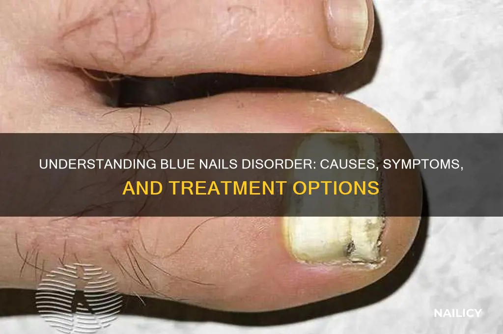what is blue nails disorder