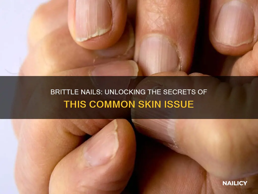 what is brittle finger nails a sign of