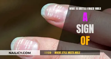 Brittle Fingernails: What Your Nails Are Trying to Tell You