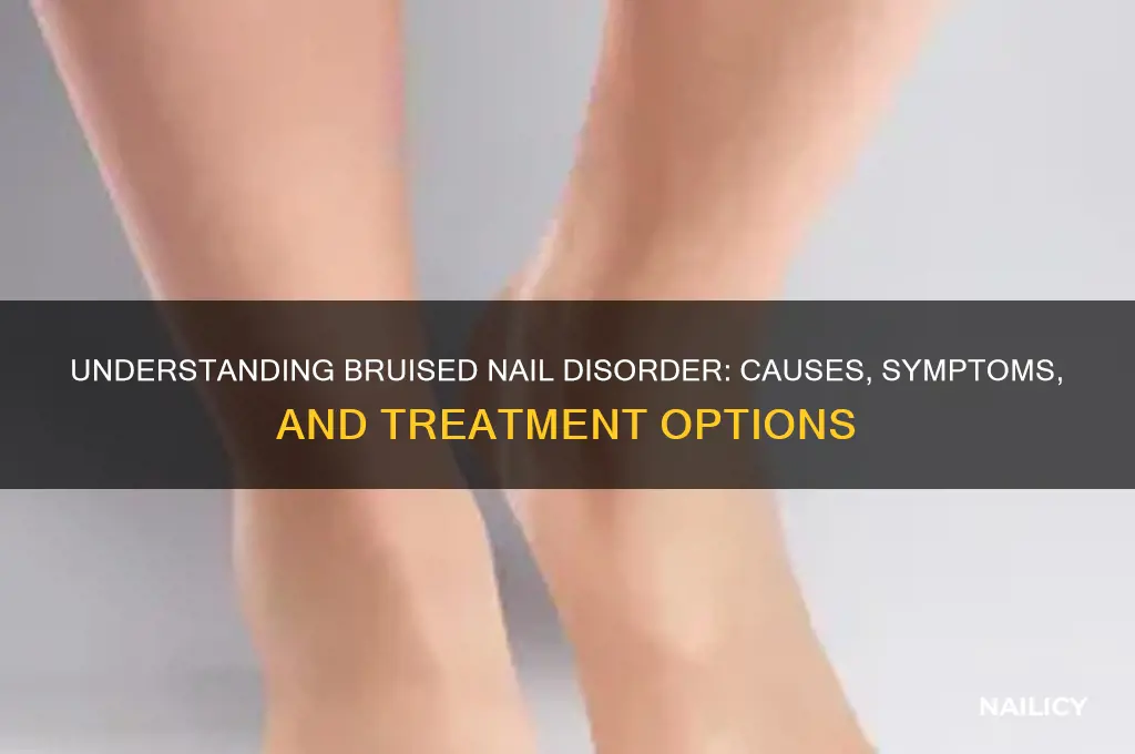 what is bruised nail disorder