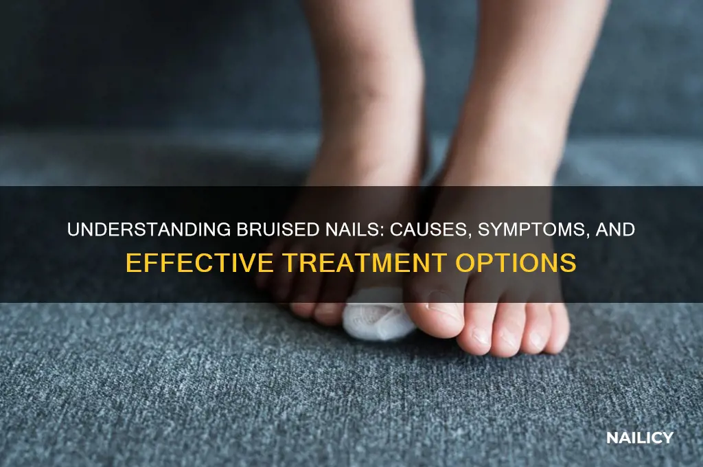 what is bruised nails