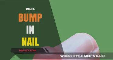 Understanding Nail Bumps: Causes, Symptoms, and Effective Treatment Options