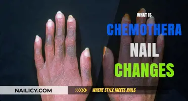 Understanding Chemotherapy Nail Changes: Causes, Symptoms, and Management Tips