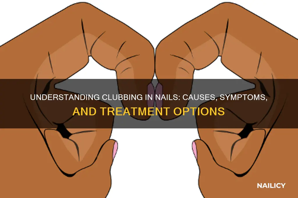 what is clubbing in nails