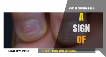 Clubbing Nails: Uncovering the Hidden Health Conditions They Signal