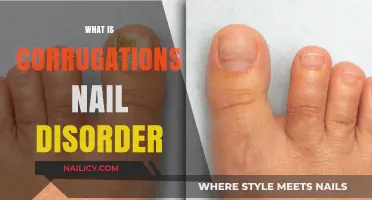 Understanding Corrugations Nail Disorder: Causes, Symptoms, and Treatment Options