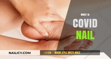 Understanding COVID Nail: Symptoms, Causes, and What It Reveals