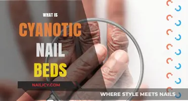 Understanding Cyanotic Nail Beds: Causes, Symptoms, and Treatment Options