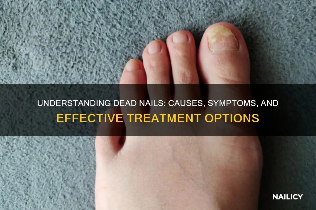 what is dead nail