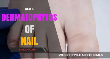 Understanding Dermatophytosis: Causes, Symptoms, and Treatment for Nail Infections