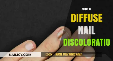 Understanding Diffuse Nail Discoloration: Causes, Symptoms, and Treatment Options