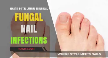 Understanding Distal Lateral Subungual Onychomycosis: Causes, Symptoms, and Treatment Options