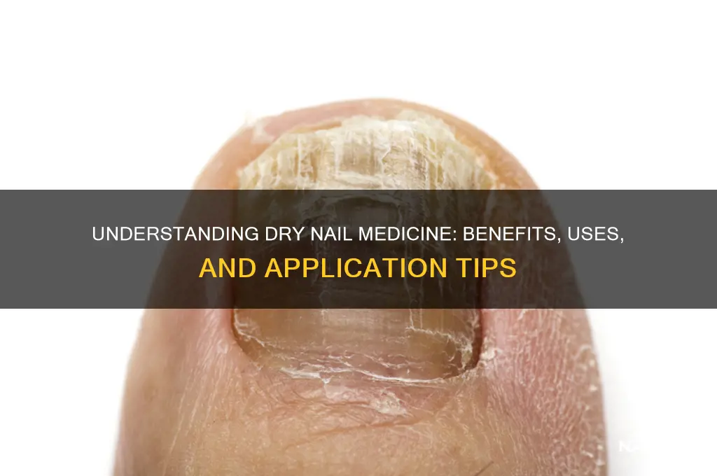 what is dry nail medicine