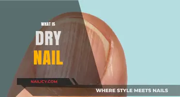 Understanding Dry Nails: Causes, Symptoms, and Effective Treatment Options