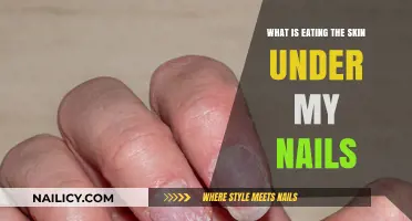 Uncovering the Cause: What’s Eating the Skin Under My Nails?