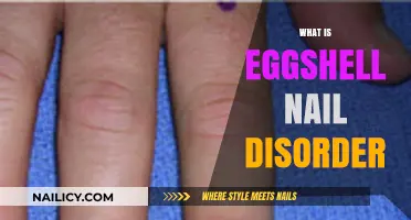 Understanding Eggshell Nail Disorder: Causes, Symptoms, and Treatment Options