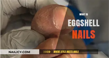 Understanding Eggshell Nails: Causes, Symptoms, and Effective Treatment Options