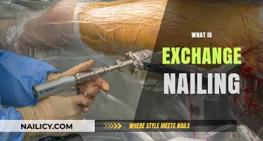Understanding Exchange Nailing: A Comprehensive Guide to Bone Fracture Repair