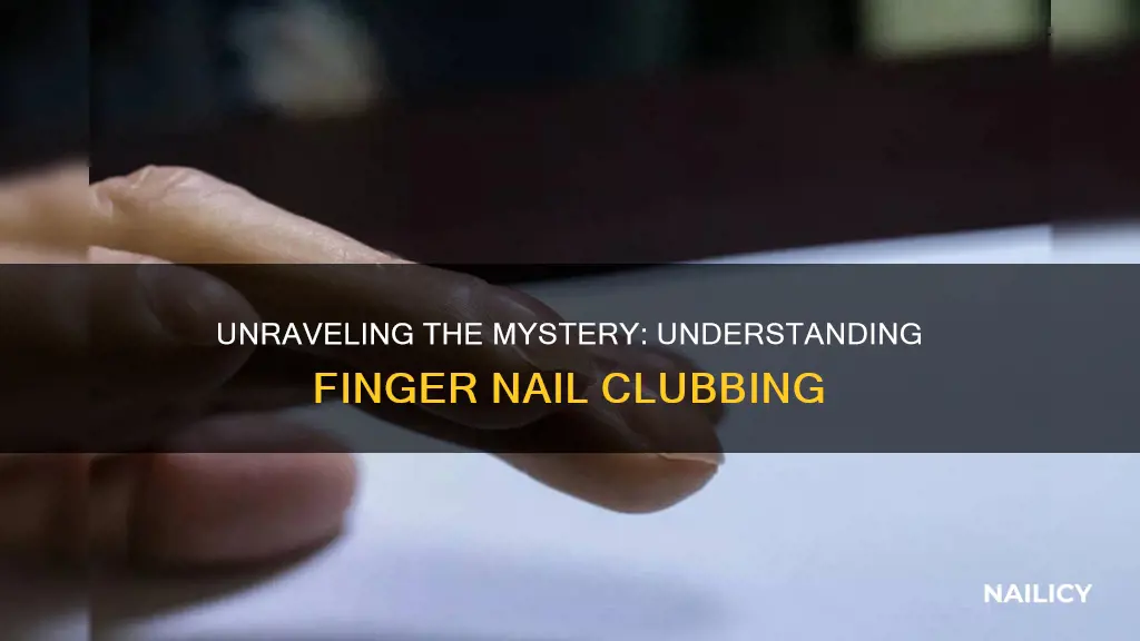 what is finger nail clubbing