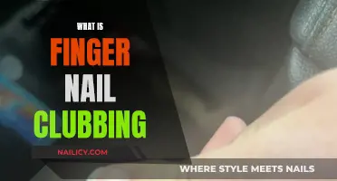 Understanding Fingernail Clubbing: An Unusual Health Indicator