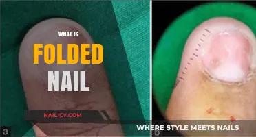 Understanding Folded Nails: Causes, Symptoms, and Effective Treatment Options