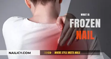 Understanding Frozen Nail: Causes, Symptoms, and Effective Treatment Options