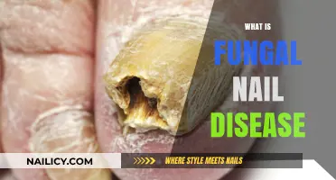 Understanding Fungal Nail Disease: Causes, Symptoms, and Treatment Options