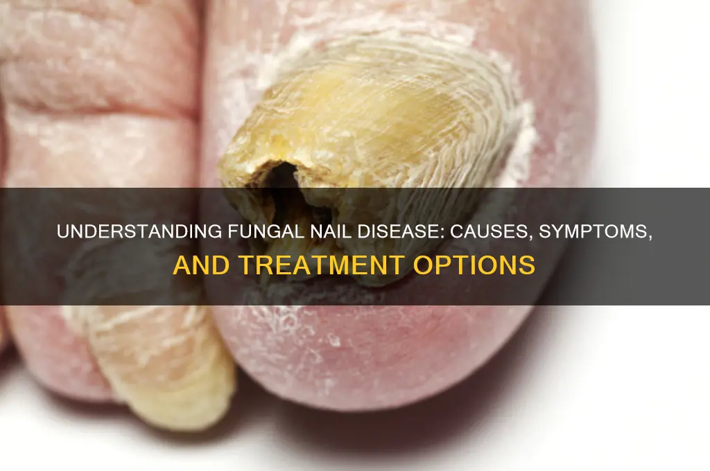 what is fungal nail disease