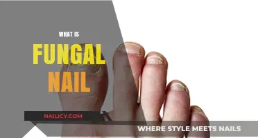 Understanding Fungal Nail Infections: Causes, Symptoms, and Treatment Options