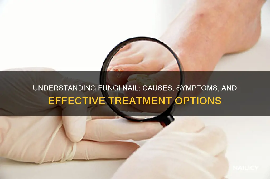 what is fungi nail