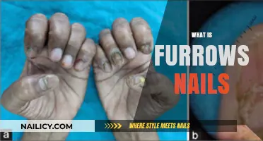 Understanding Furrows Nails: Causes, Symptoms, and Treatment Options Explained