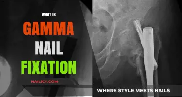 Understanding Gamma Nail Fixation: A Comprehensive Guide to Hip Fracture Treatment