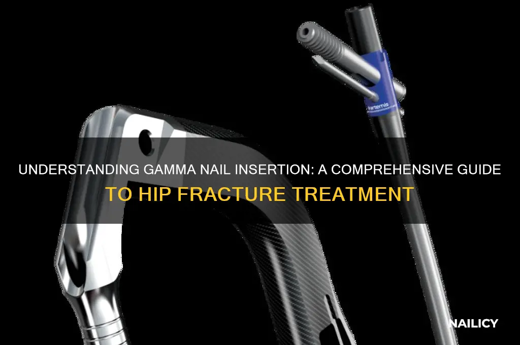 what is gamma nail insertion