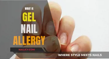 Gel Nail Allergies: Symptoms and Causes Explained