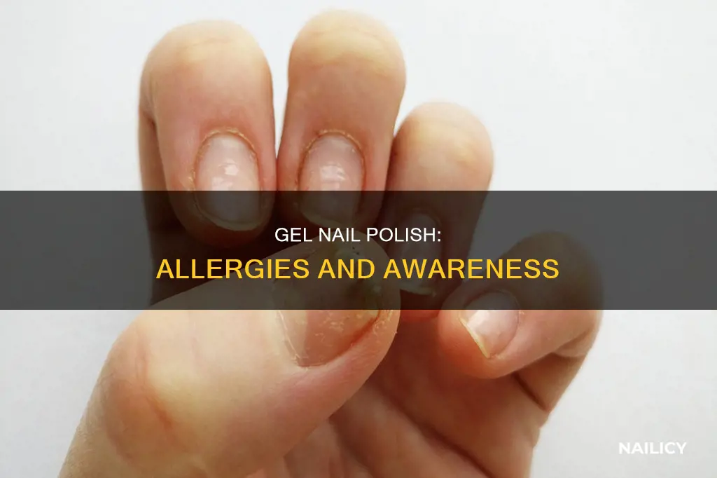 what is gel nail polish can i be allergic to