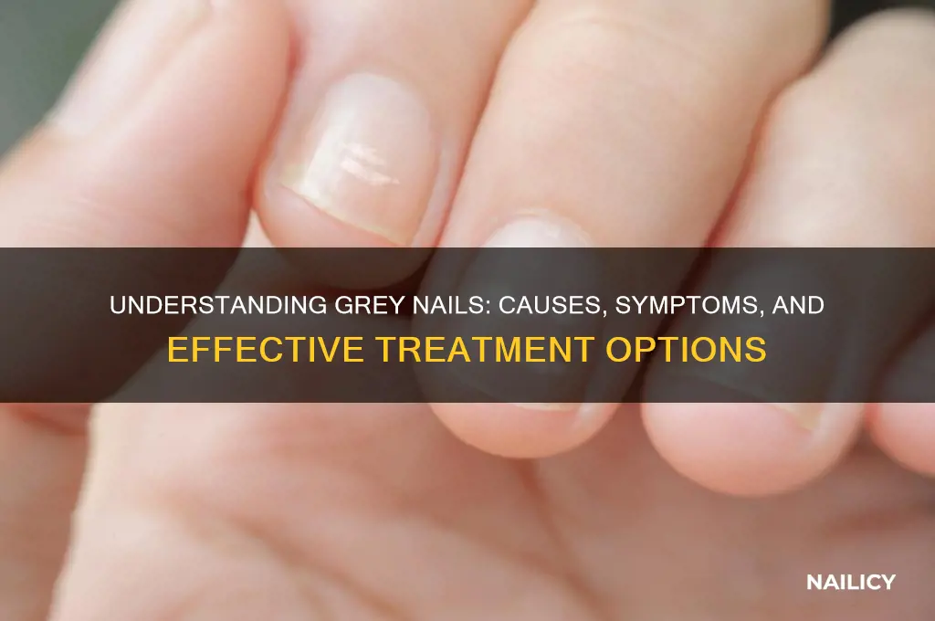 what is grey nails