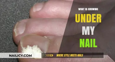 The Mystery Under Your Nails